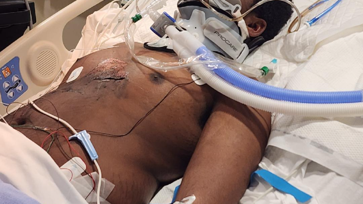 Donate to help a mother who's son is on life support campaign photo, 1 of 3