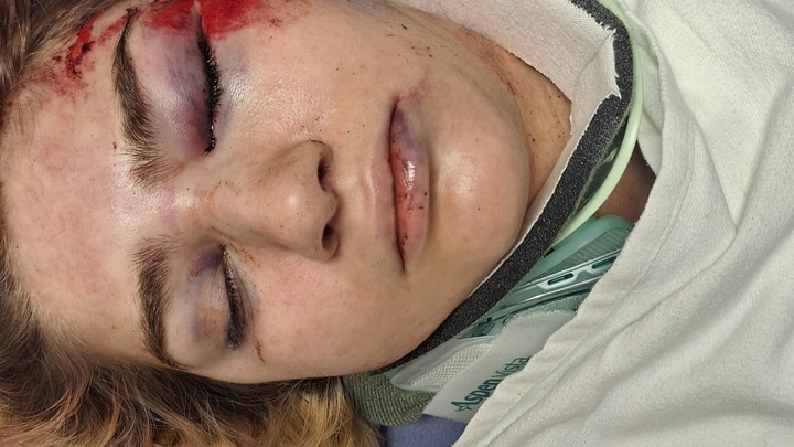 Aid Scott's Daughter in Her Road to Recovery campaign photo, 1 of 7