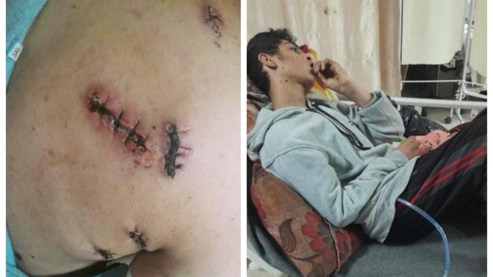 Main fundraiser photo