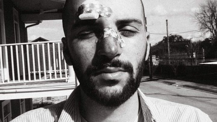 Fundraiser by Joshua Cutrer : Help Joshua Recover After Bike Accident