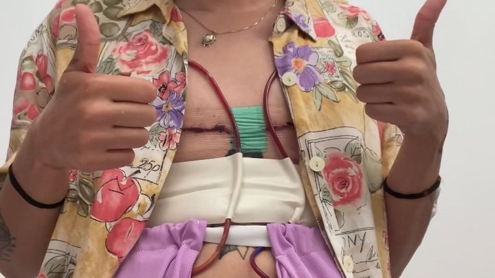 Housing and Top surgery aftercare campaign photo, 1 of 2