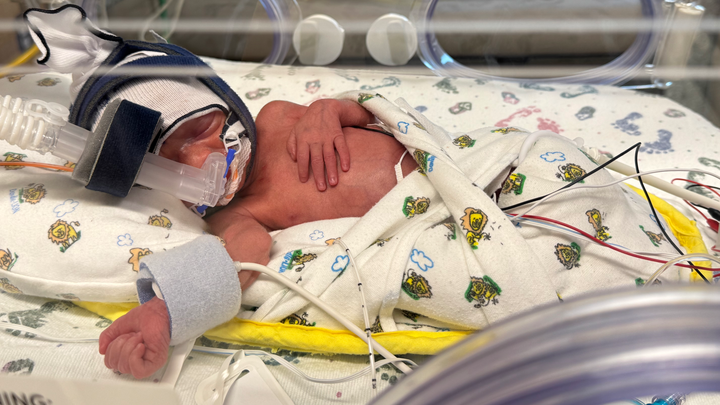 Support Hadlee's NICU Journey campaign photo, 1 of 4