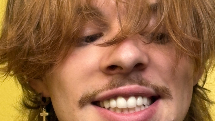 Support The Smile Project: Transform Lives campaign photo, 1 of 8