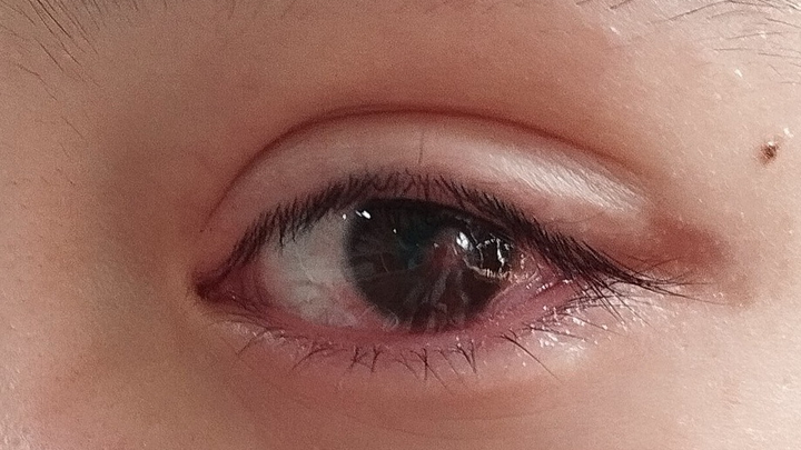 Help Our Refugee Family Cover Urgent Eye Treatment Costs campaign photo, 1 of 7