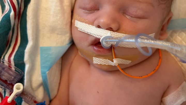 Finnian's CDH Journey campaign photo, 1 of 3
