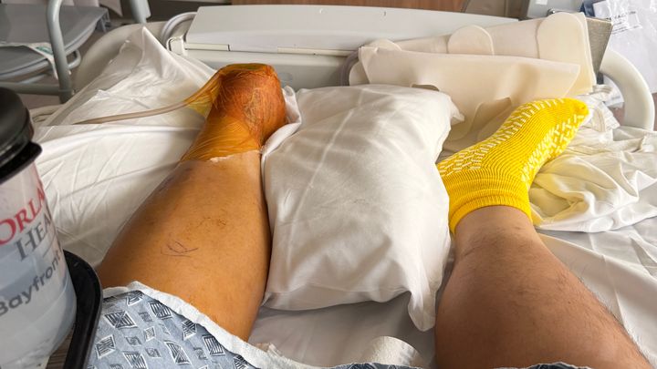 Help Adam Recover After Foot Amputation campaign photo, 1 of 8