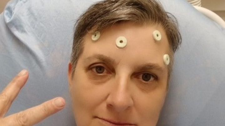 Help Dale Continue her fight against a rare brain tumour campaign photo, 1 of 3