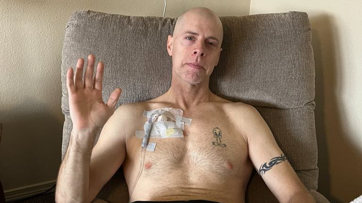 Billy Butler, father of 4 fighting Goblet Cell Adenocarcinom campaign photo, 1 of 6