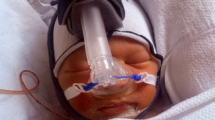 Support for Baby Axel and Family campaign photo, 1 of 8