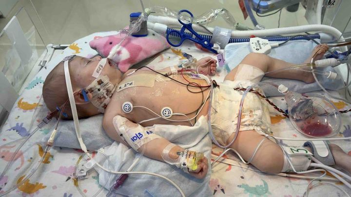 Help Baby Harley Fight for Her Heart campaign photo, 1 of 2