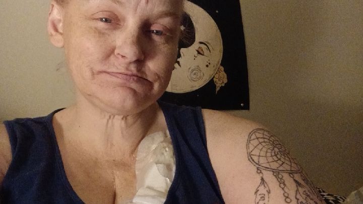 Help Mom Fight very aggressive stage 4 small bowl cancer campaign photo, 1 of 5