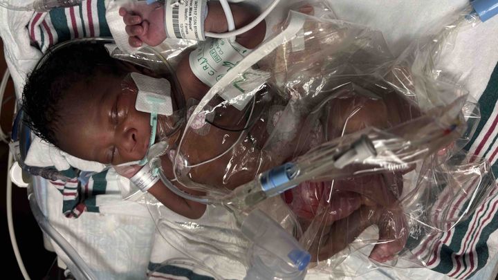 Support Miór Miracle Dumercy's Healing Journey campaign photo, 1 of 8