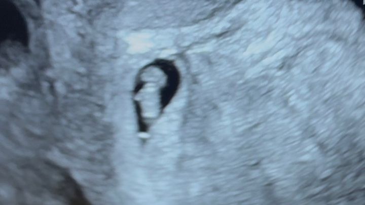 Help with our Ivf journey campaign photo, 1 of 3