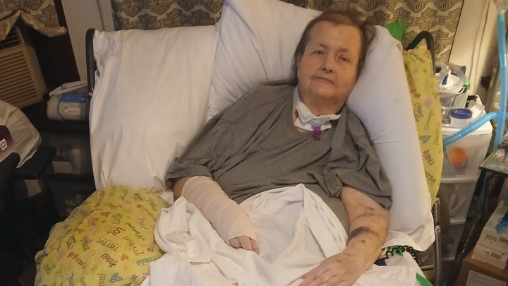 Support Donna's In-Home Oxygen Needs campaign photo, 1 of 3