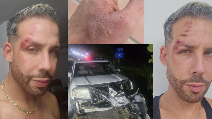 Después de un accidente fuerte, hoy me toca pedir ayuda campaign photo, 1 of 3
