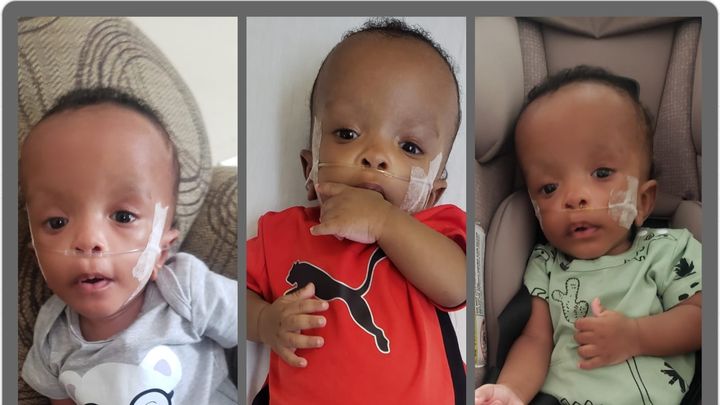 Fundraiser by Marsha Roach : Kai's medical expenses