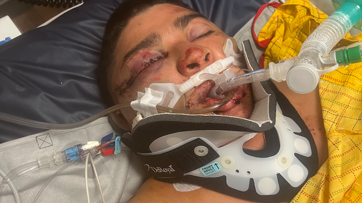 Support Jordon's Road to Recovery campaign photo, 1 of 6