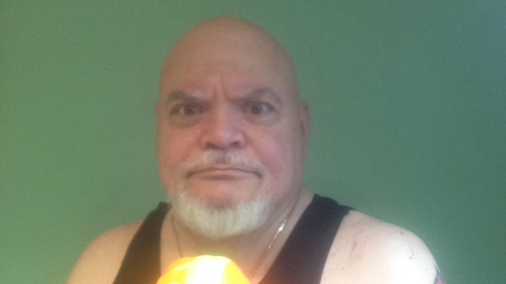 Help Eads Blaser Afford a Prosthetic Leg campaign photo, 1 of 4