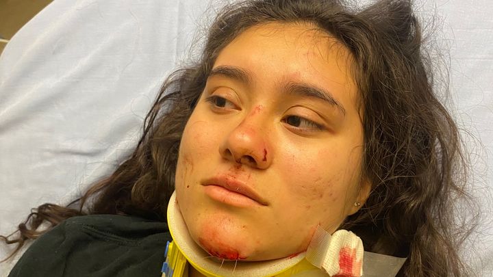 Help Me Recover After a Serious Bike Accident campaign photo, 1 of 5