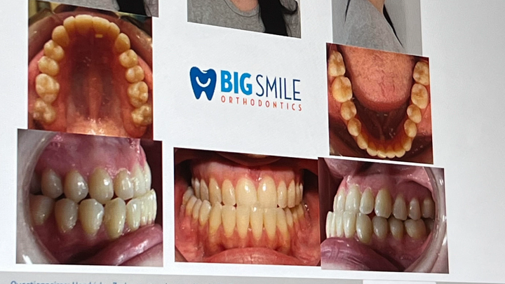 Support Sarah's Urgent Jaw Surgery Fund campaign photo, 1 of 6