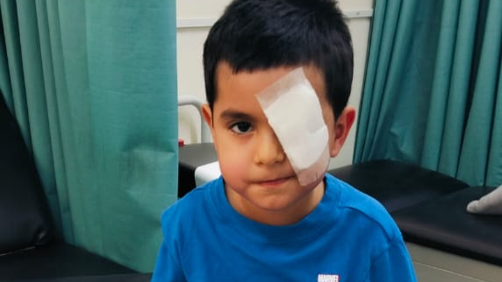 Foto de la recaudación de fondos AYUDAME A COMPRAR MI PROTESIS OCULAR, 1 de 5