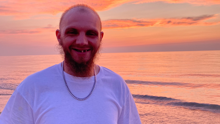 Foto van campagne 29 yr old cancer survivor desperately needs teeth, 1 van 8