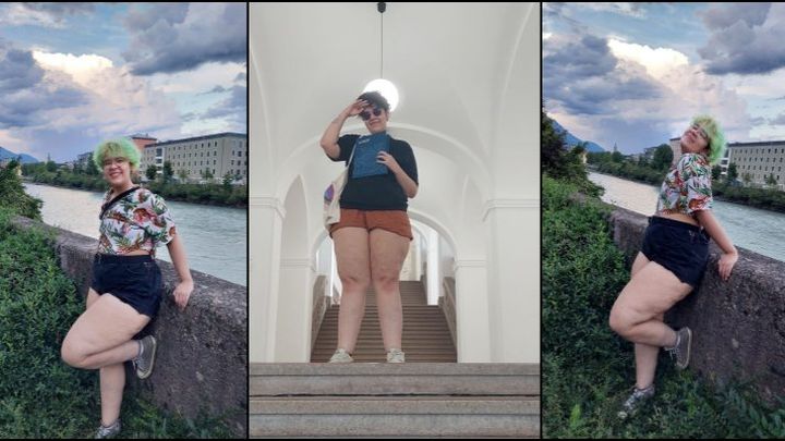 help me afford my lipedema surgery✨ campaign photo, 1 of 4