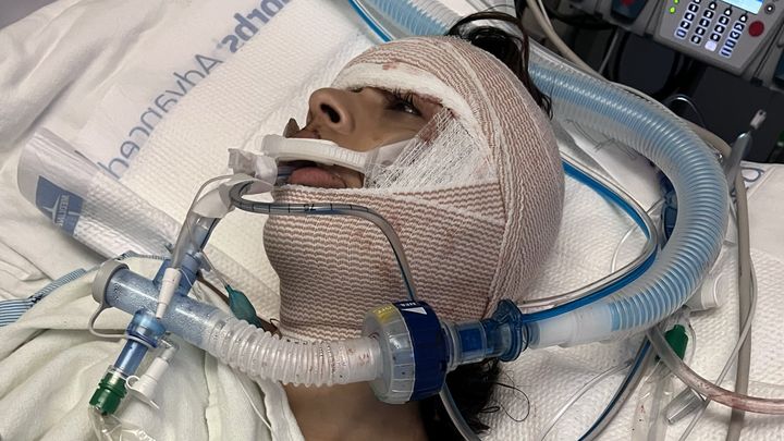 Help the Rodriguez Family with their Daughter's Accident campaign photo, 1 of 4