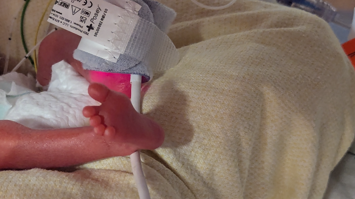 Support Beckett's NICU Journey campaign photo, 1 of 8