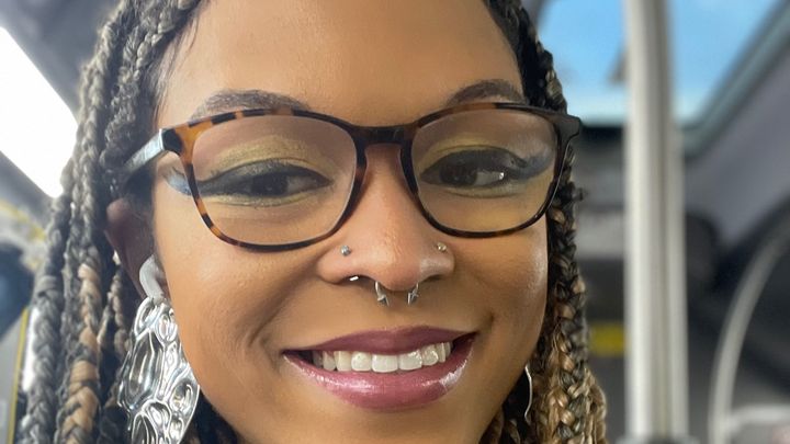 Help support Jaylon with her surgery campaign photo, 1 of 3
