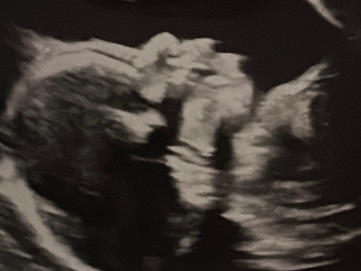 Fundraiser’s main image