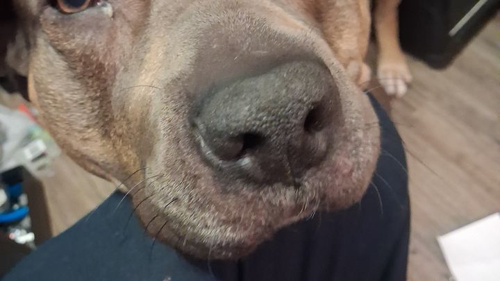 Help Zena Get Life-Saving Surgery campaign photo, 1 of 3