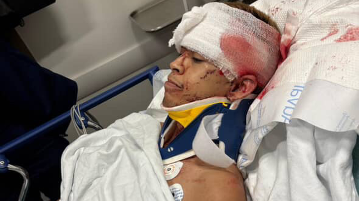 Help my brother recover from accident campaign photo, 1 of 3