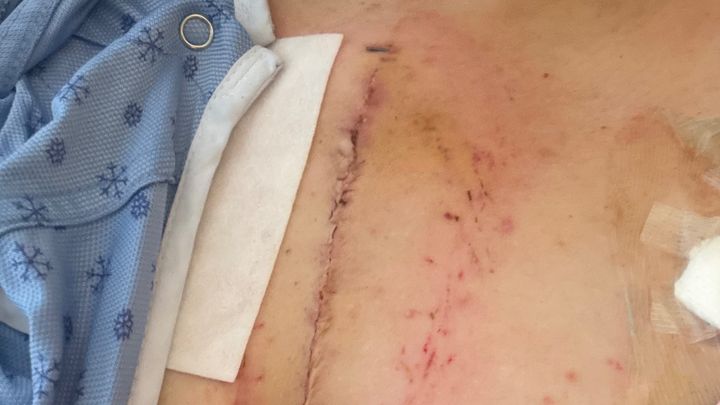 Christina’s Heart Surgery Recovery Fund campaign photo, 1 of 8