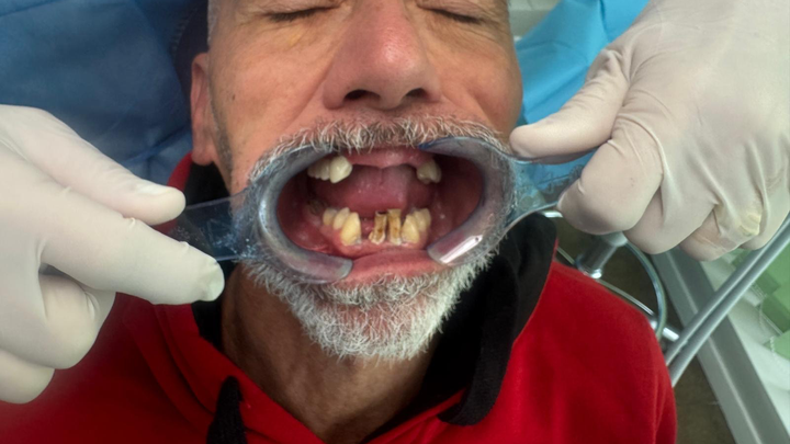 Cure dentarie campaign photo, 1 of 4