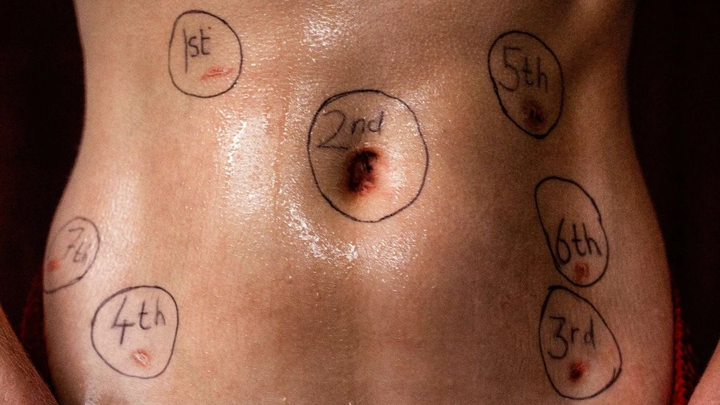 Help me spread awareness for Endometriosis campaign photo, 1 of 3