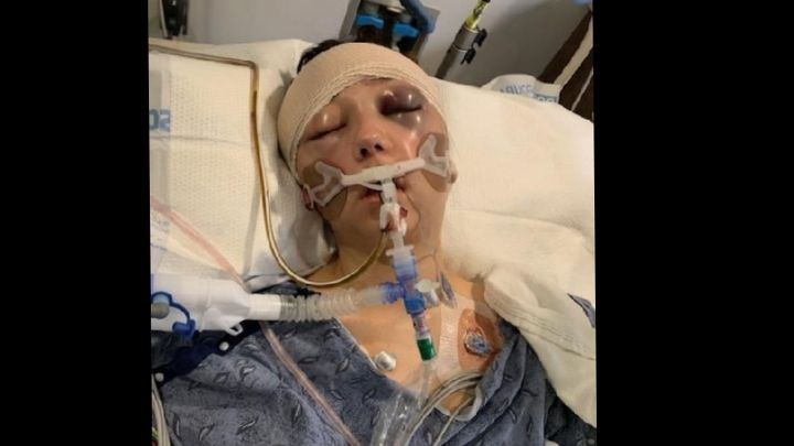 Main fundraiser photo