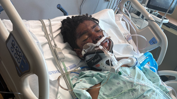 Help Harllen Heal After Tragic Accident campaign photo, 1 of 7