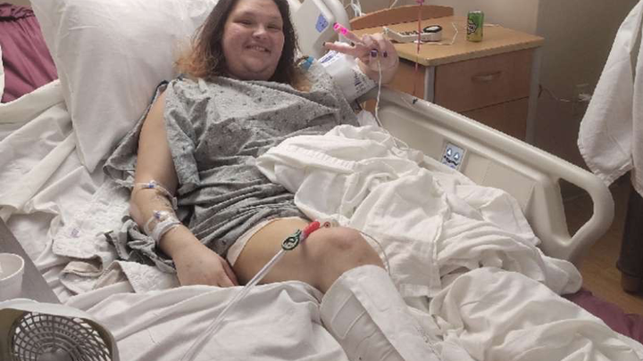She saved her own life. Please help her heal. campaign photo, 1 of 8