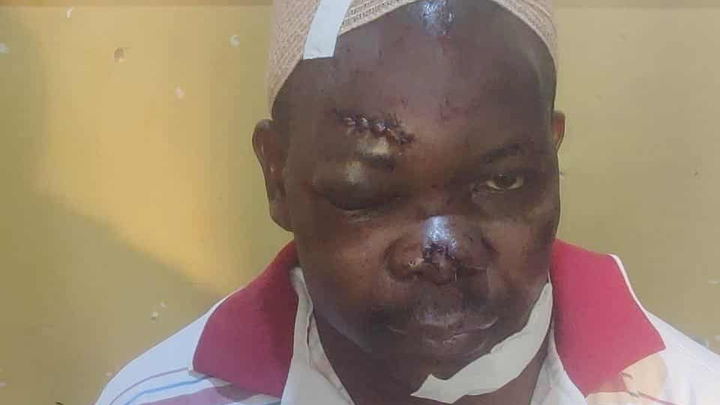Help Pastor Alex Recover After a Tragic Attack campaign photo, 1 of 3