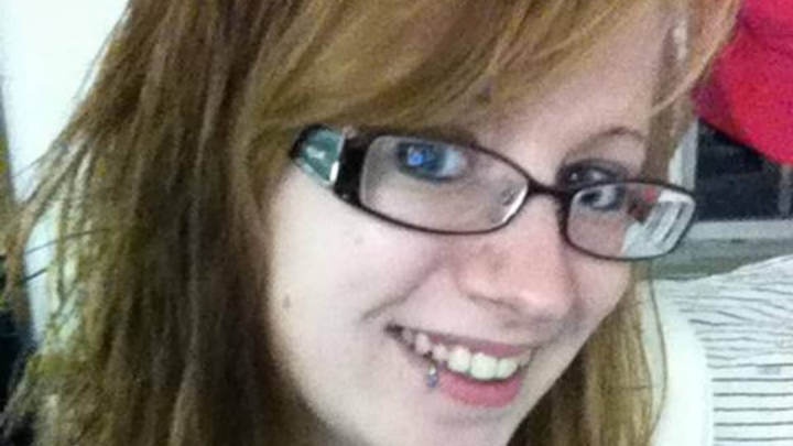 Restoring Shannon's Smile after gum disease! campaign photo, 1 of 3