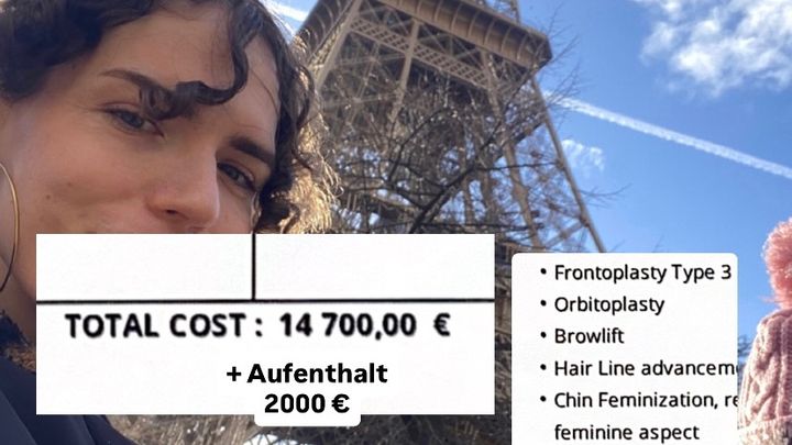 Kampagnen-Foto für GESICHTSFEMINISIERUNG FÜR LENI, 1 von 3