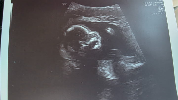 Help Cory & Brittanys Health Issues & Safety of Baby Boy campaign photo, 1 of 7