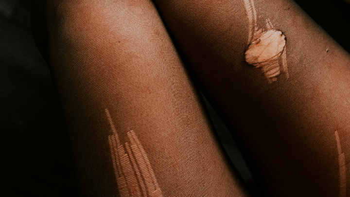 The Pantyhose Project campaign photo, 1 of 3