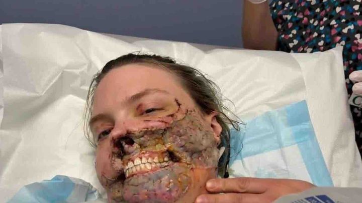 Help with nose transplant surgery campaign photo, 1 of 5