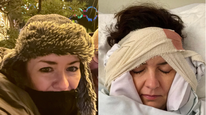 When Even Smiling Hurts – Help Saffron Get Her Life Back campaign photo, 1 of 8