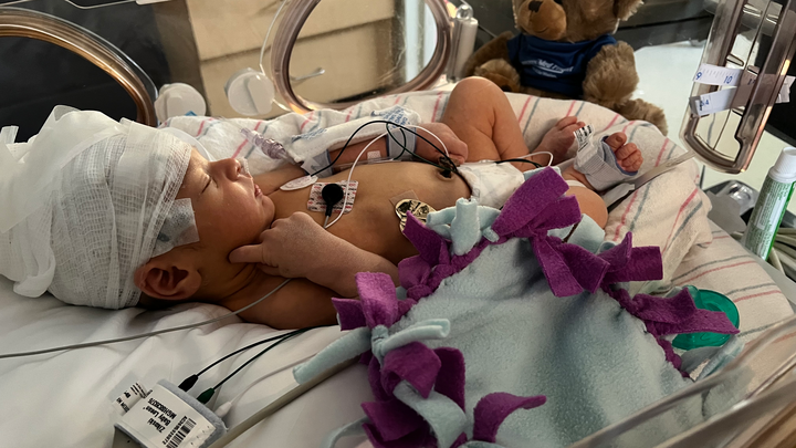 Support Baby Robbie’s Stroke Rehabilitation campaign photo, 1 of 8