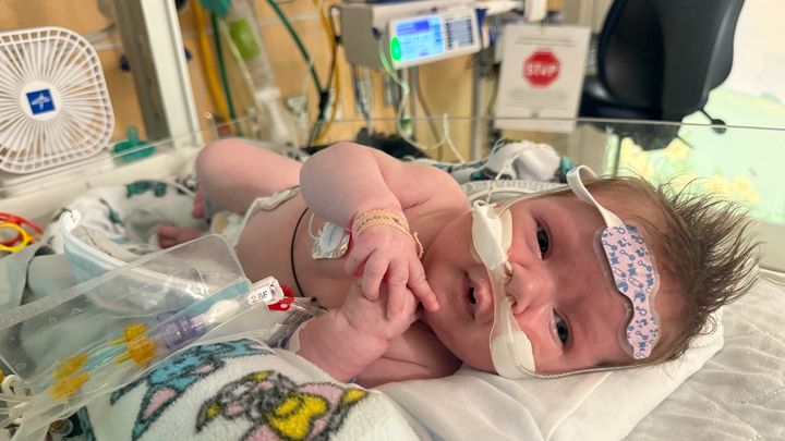 Help Lorelei's Family Through Her Lung Transplant Journey campaign photo, 1 of 5