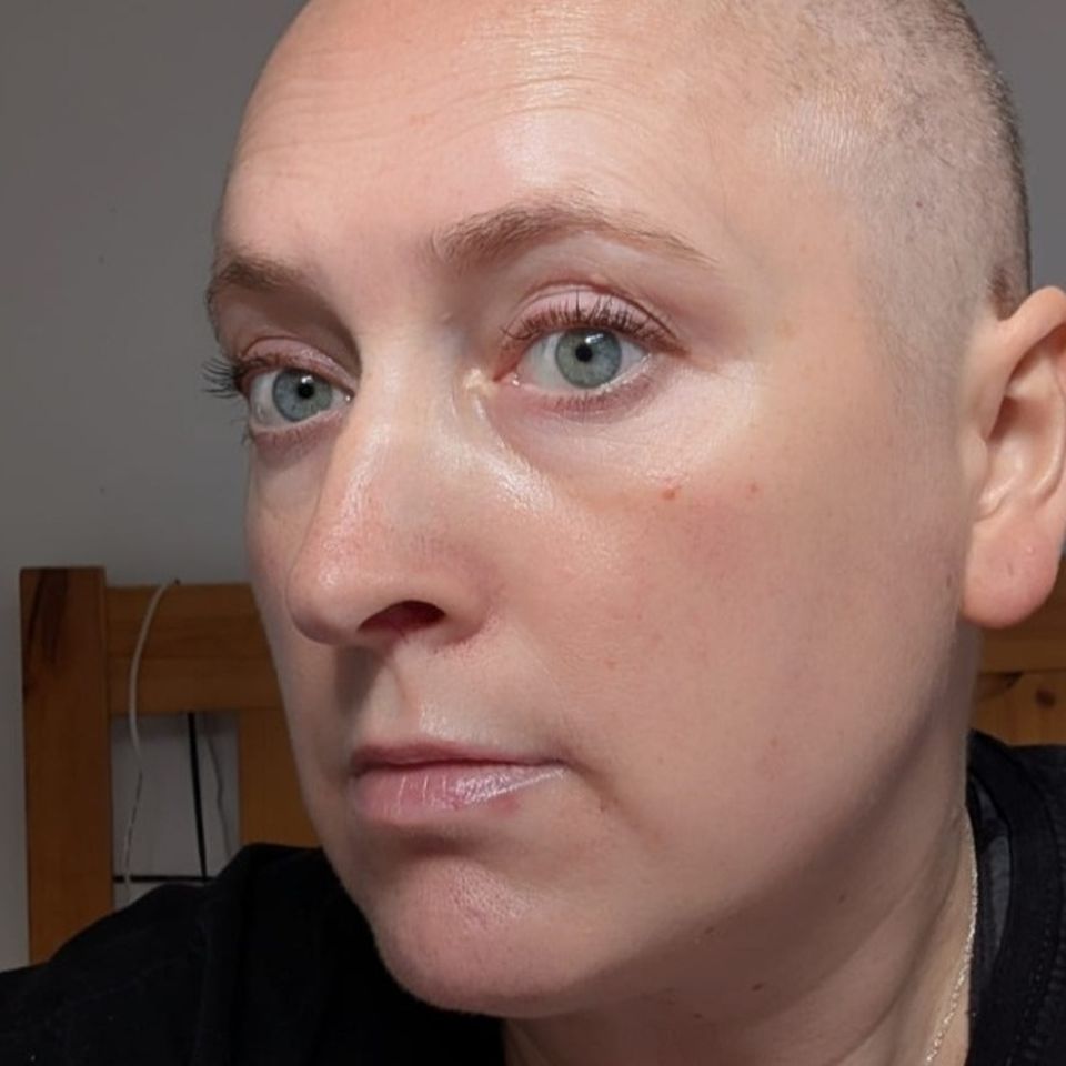 Please help Aiga in battle with cancer