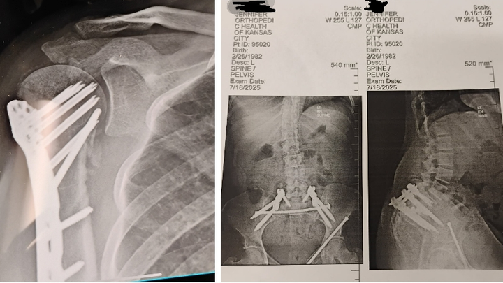 Help after critical accident & long hospital stay campaign photo, 1 of 6